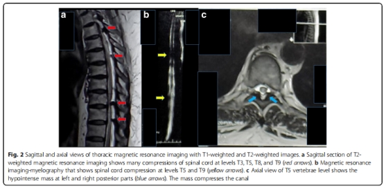 臨床試驗 臨床試驗