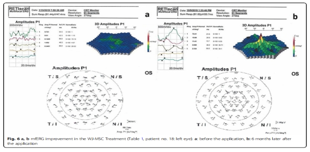 臨床試驗 臨床試驗