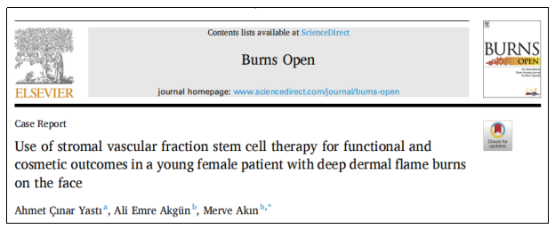 干細胞治療 干細胞治療