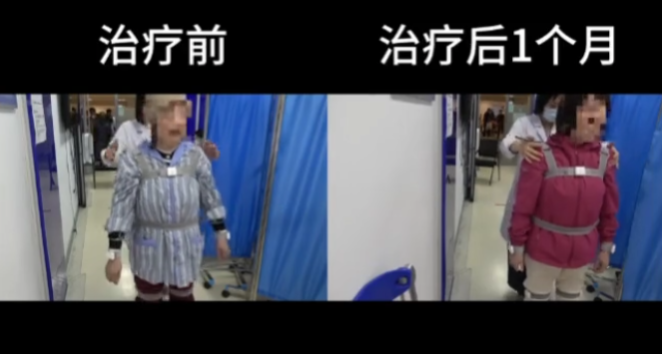 沈女士康復(fù)過程 沈女士康復(fù)過程