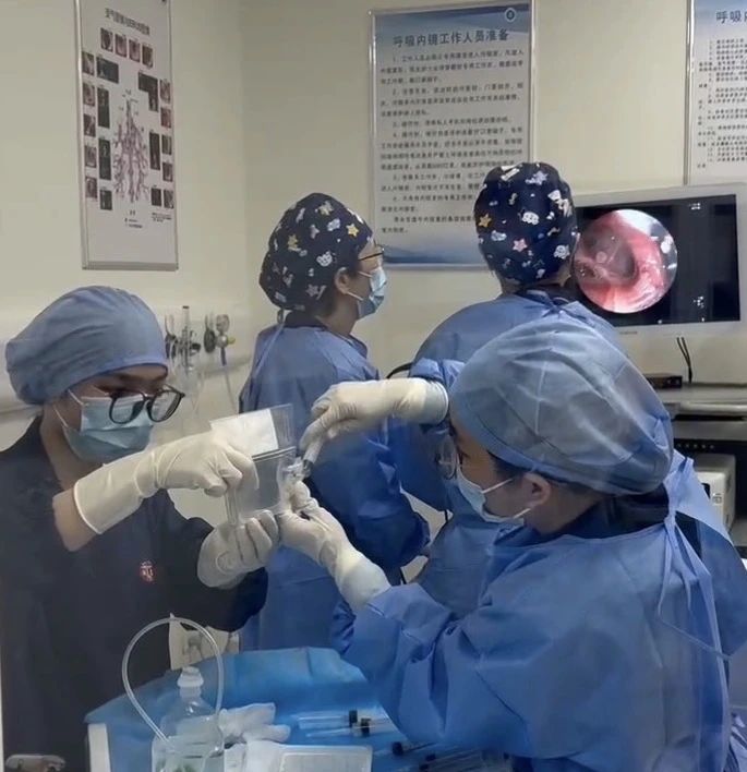首例慢阻肺病患者順利完成干細胞治療,由瑞金醫院周敏教授(左二)完成支氣管鏡給藥操作 首例慢阻肺病患者順利完成干細胞治療,由瑞金醫院周敏教授(左二)完成支氣管鏡給藥操作