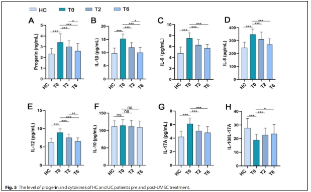 圖5 HC和UC思者在UMSC治療前后的progerin和細胞因子水平 圖5 HC和UC思者在UMSC治療前后的progerin和細胞因子水平