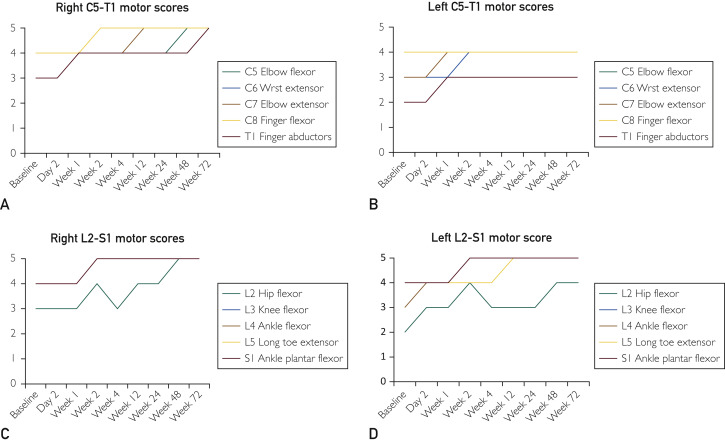 圖3:受試者各時間點脊髓損傷神經(jīng)學分類國際標準運動評分。A,右上肢運動評分。B,左上肢運動評分。C,右下肢運動評分。D,左下肢運動評分。 圖3:受試者各時間點脊髓損傷神經(jīng)學分類國際標準運動評分。A,右上肢運動評分。B,左上肢運動評分。C,右下肢運動評分。D,左下肢運動評分。